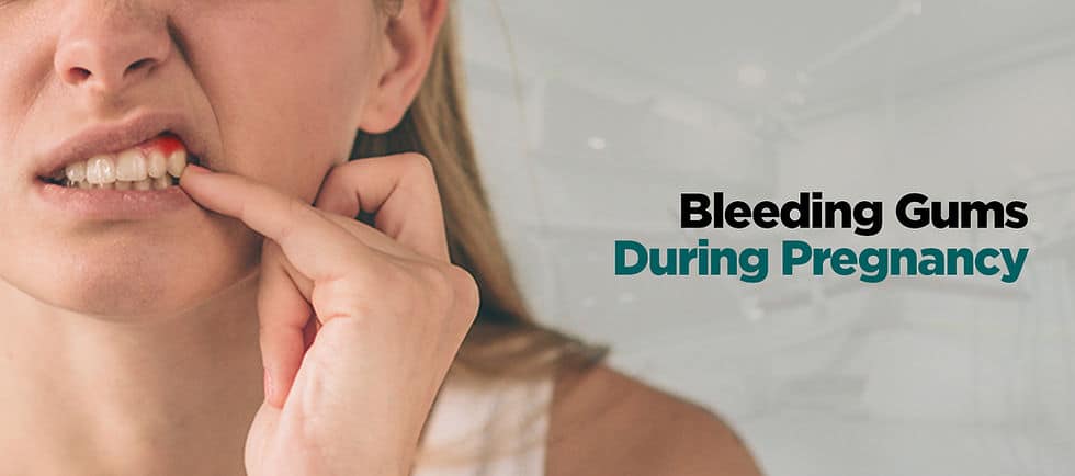 Bleeding gums during pregnancy