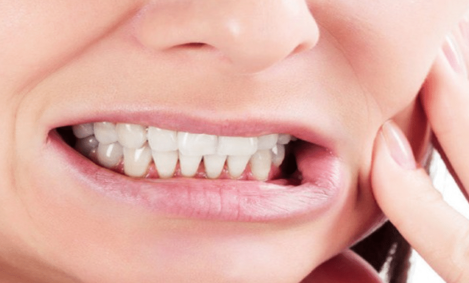 Teeth Grinding (Bruxism) - the risks involved. 1 Person clenching their teeth